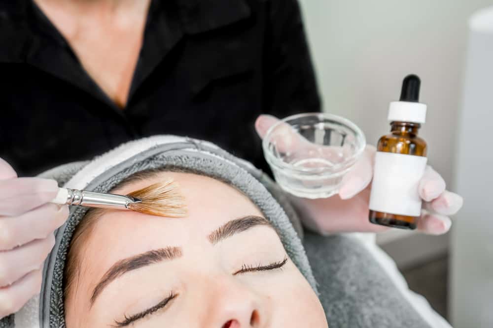 How to prepare for a chemical peel